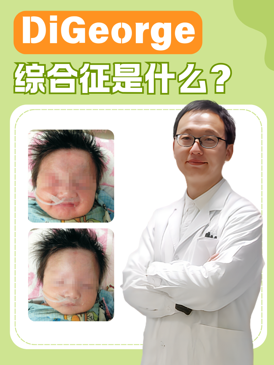 什么是类癌综合征