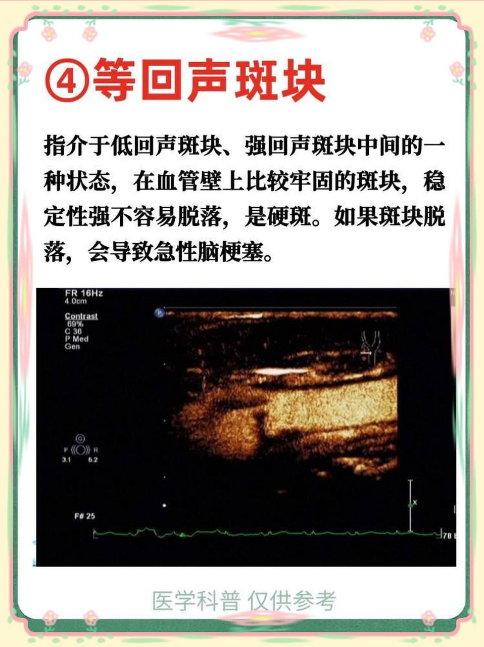 颈部彩超是检查什么的