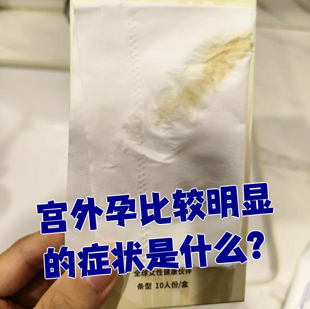 宫外孕的症状有什么