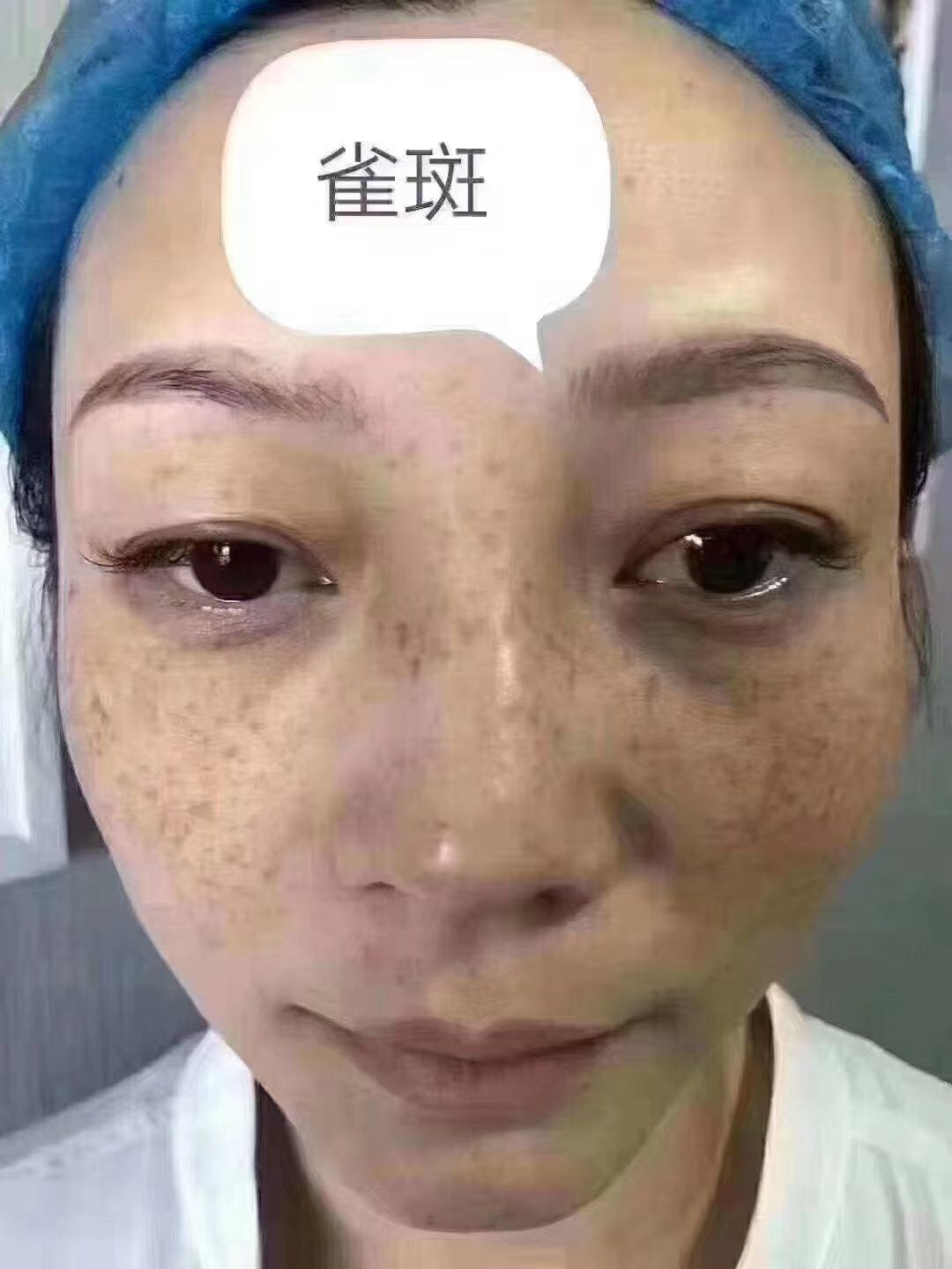 脸上有黑斑,吃什么好??..