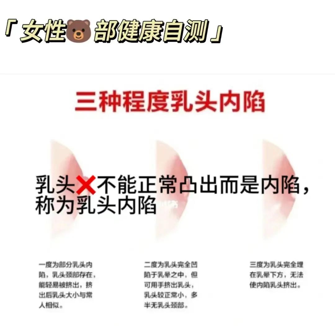 什么是乳头内陷?