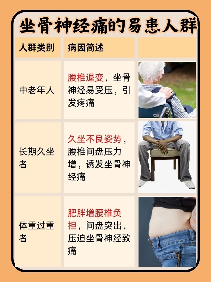 坐骨神经痛看什么科