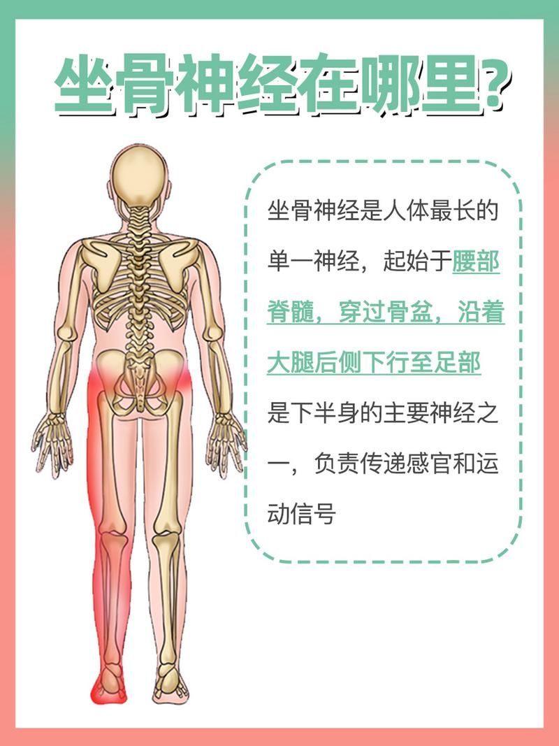 坐骨神经痛看什么科