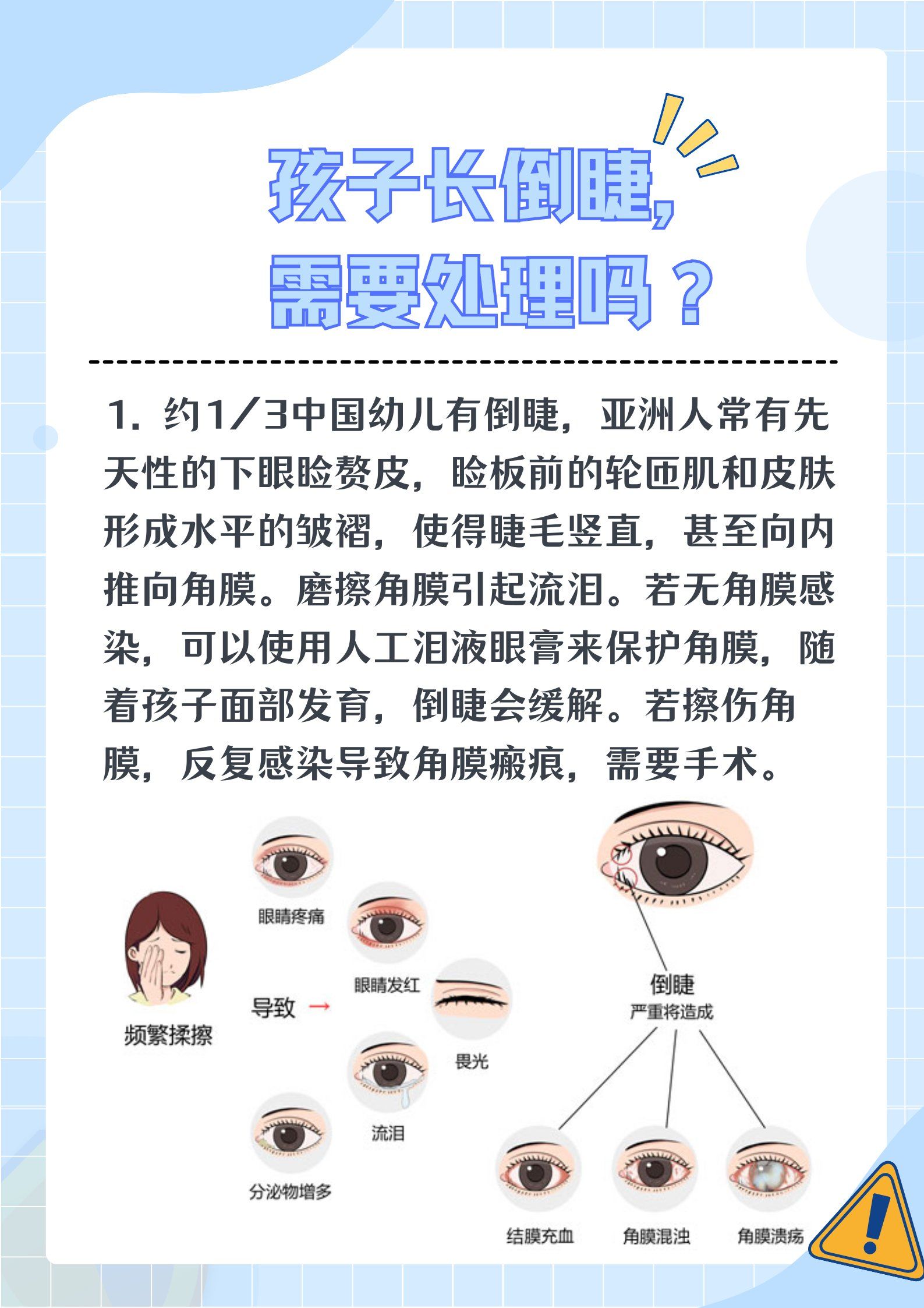 宝宝倒睫毛怎么办