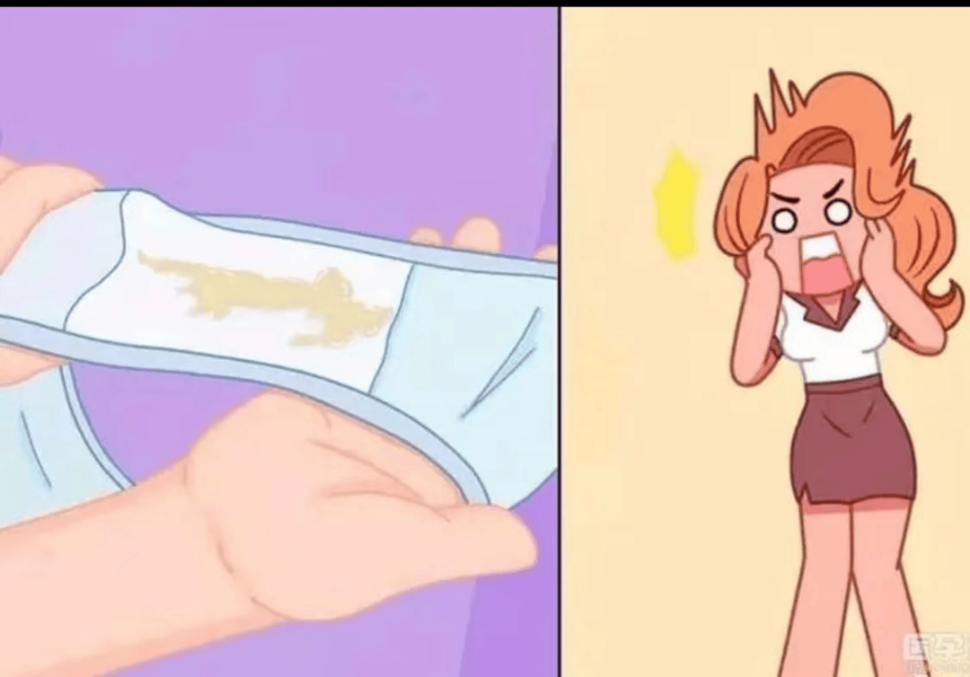 阴道炎有哪些症状表现