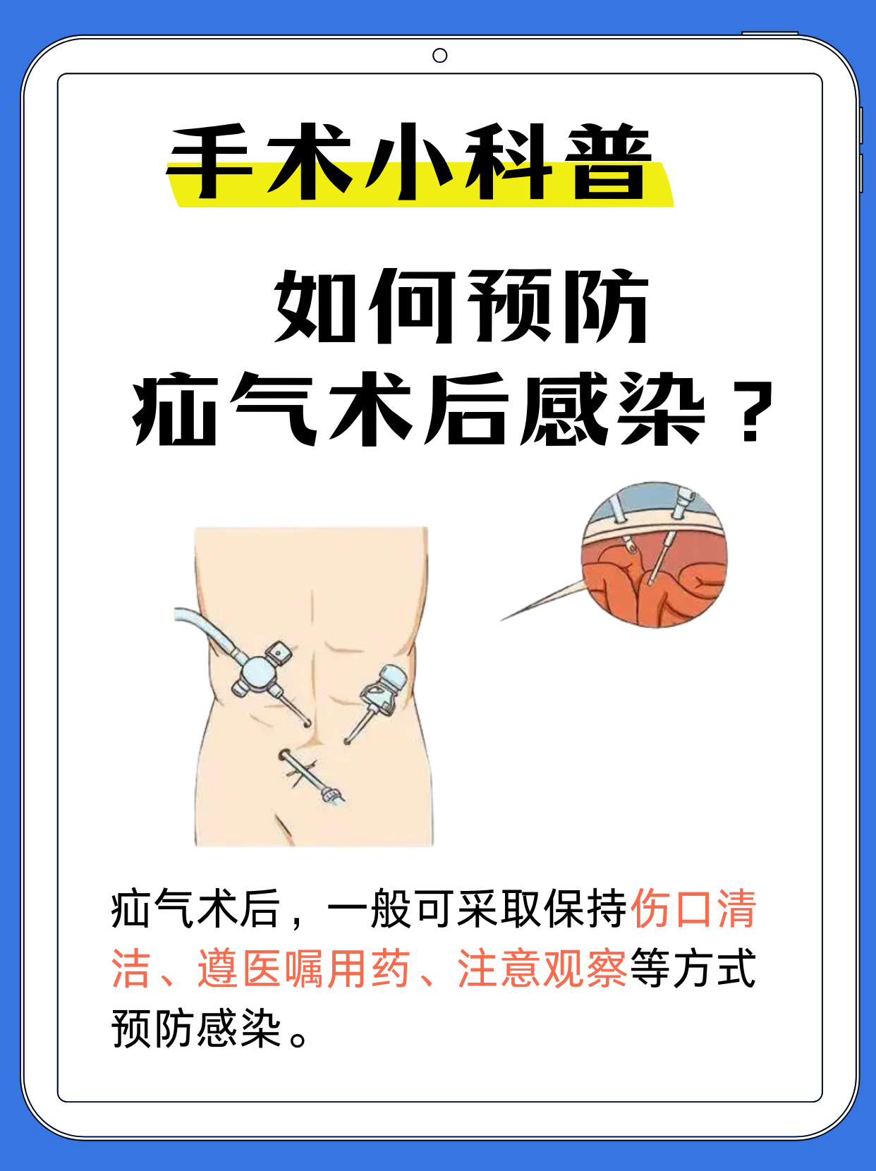 腹腔镜手术后怎样防止粘连