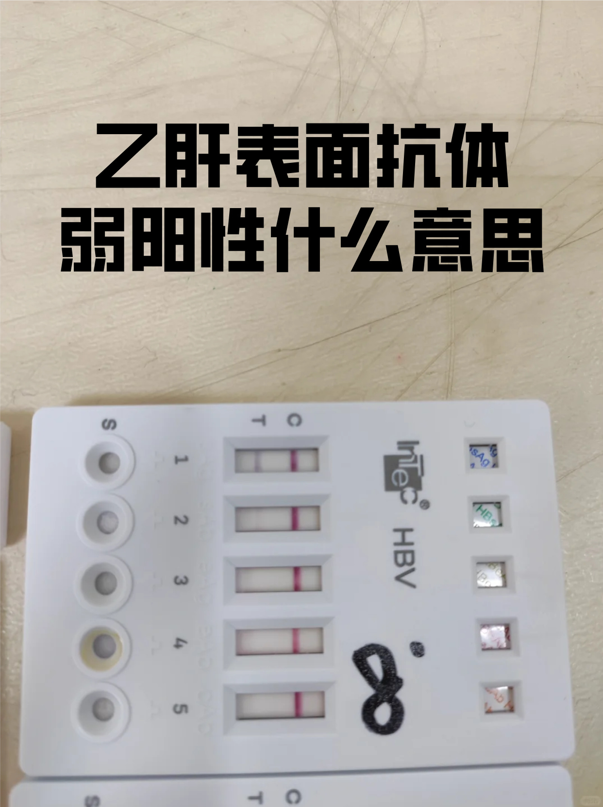 乙肝表面抗体100多好吗