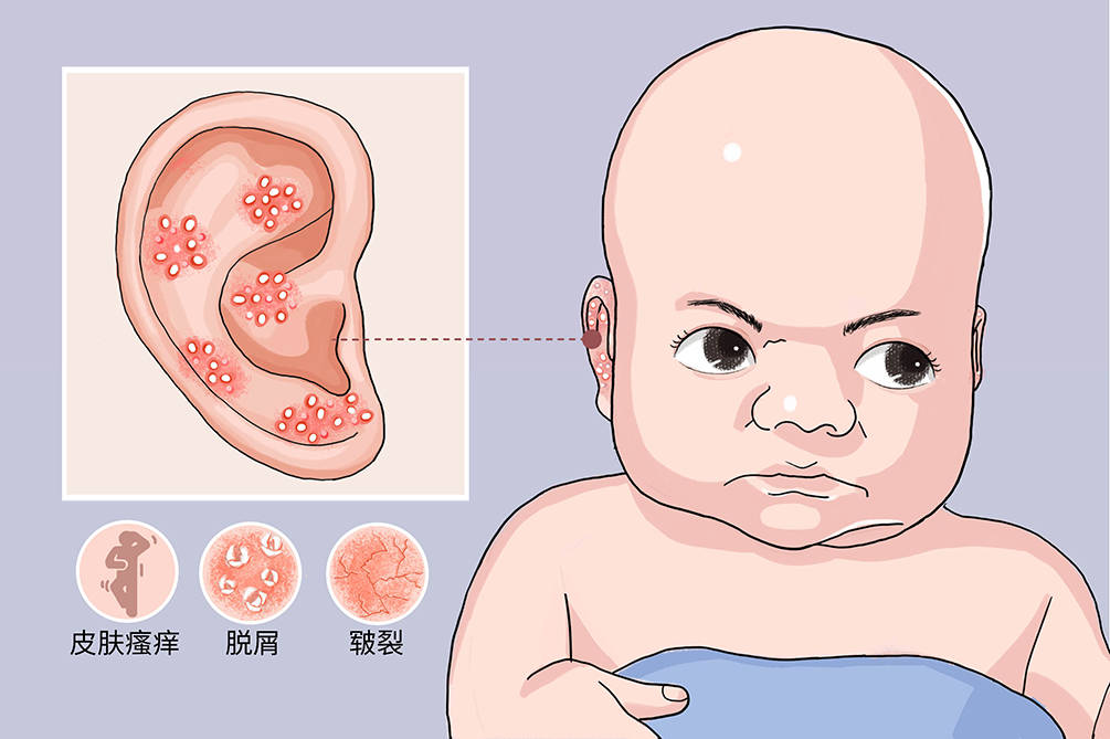 幼儿得中耳炎的症状