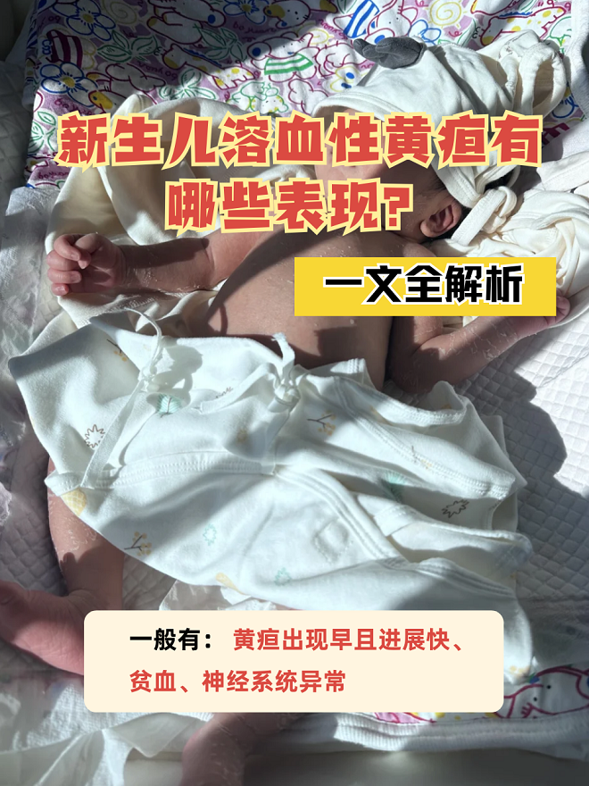 一岁宝宝皮肤黄是怎么回事