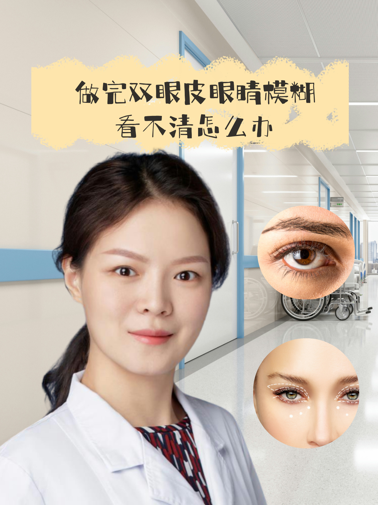 上海哪里开双眼皮好啊