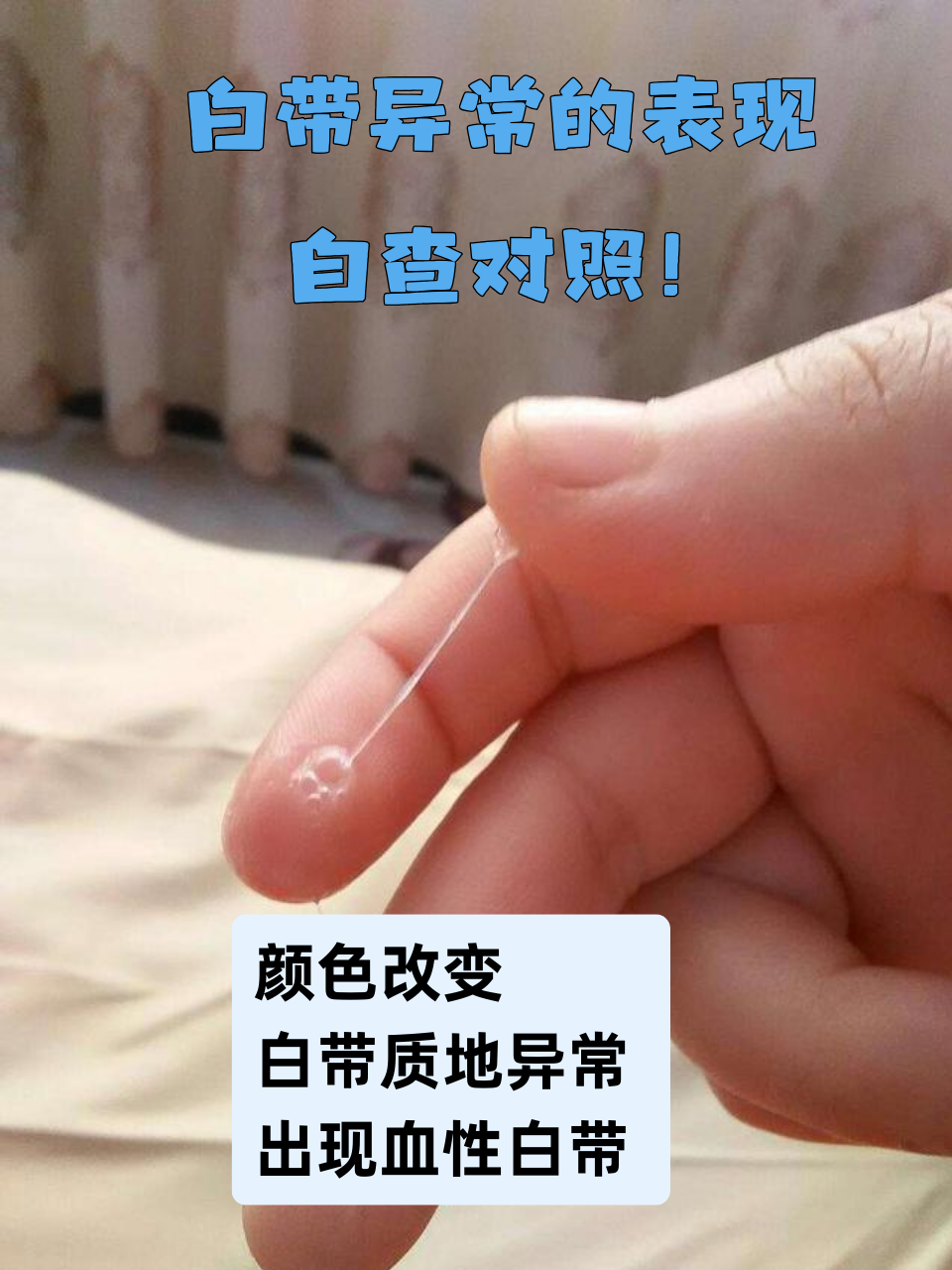 什么是白带?