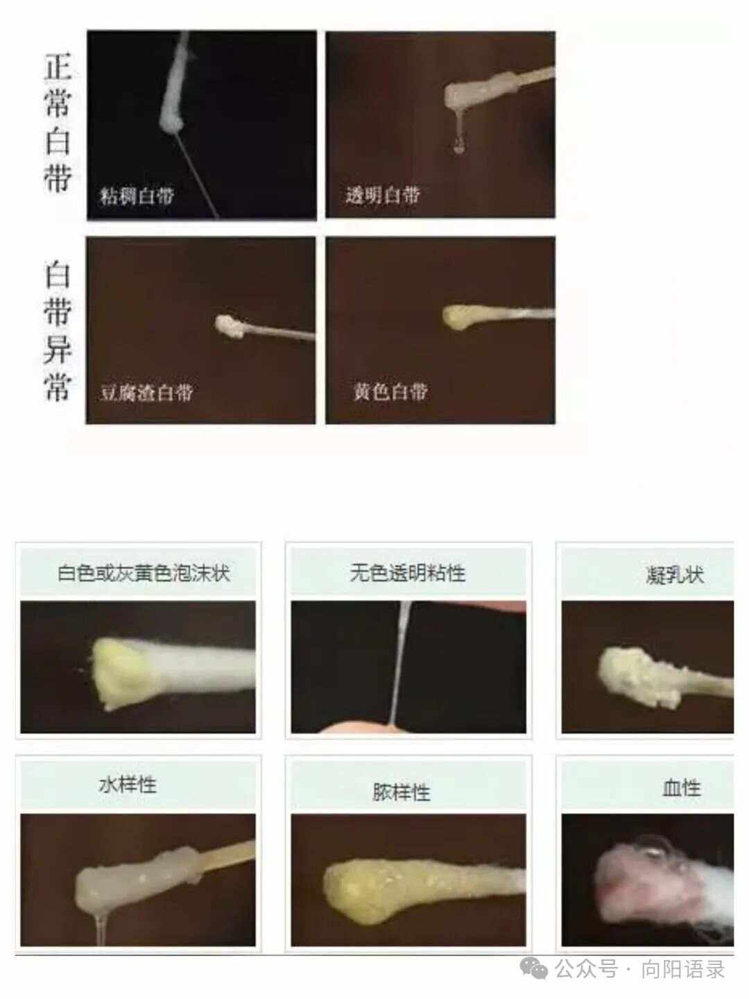 什么是白带?