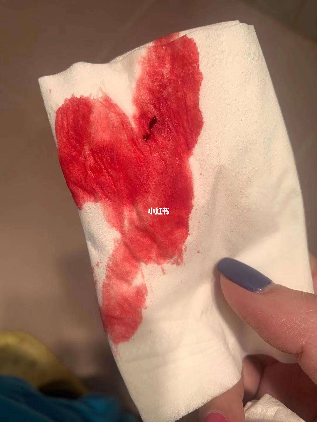 月经8天还没干净,血色鲜红