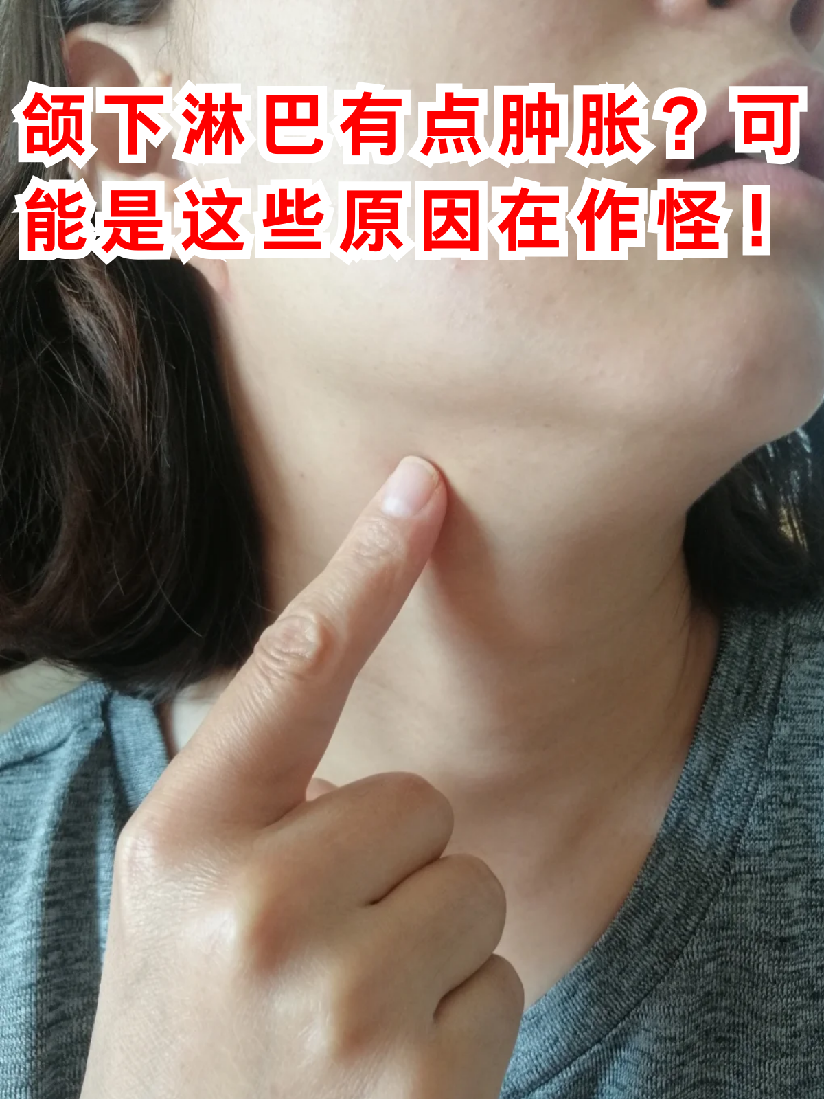 颌下腺炎是什么病