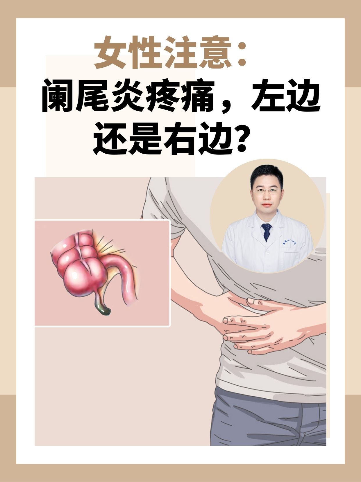 慢性阑尾炎怎么办