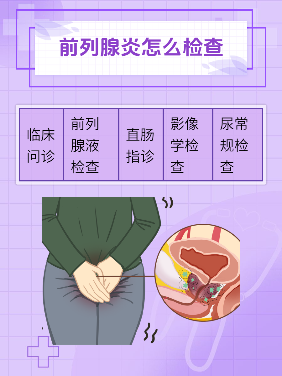 什么是前列腺炎