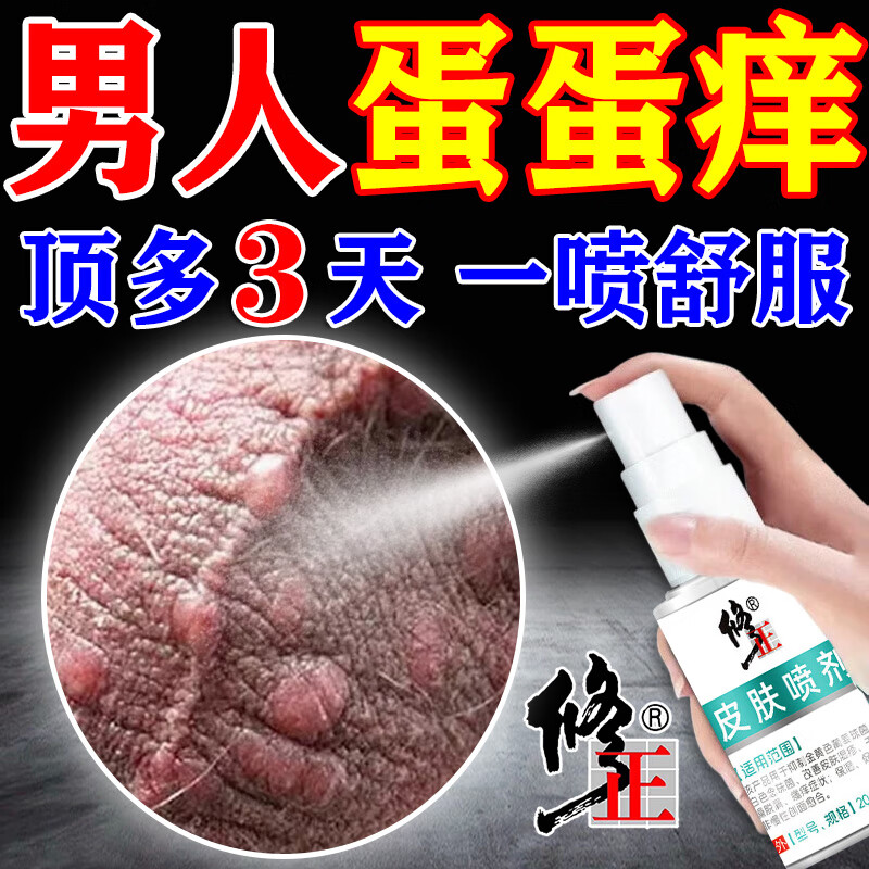 阴囊潮湿瘙痒,有时候会有尿急