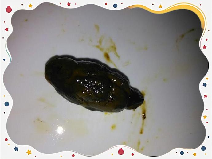 拉黑色大便是什么情况