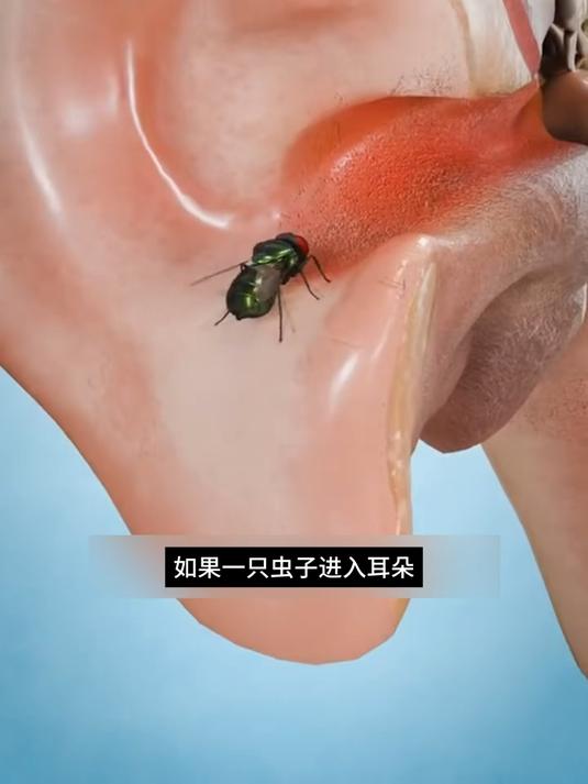耳朵痒感觉有虫子在爬一样