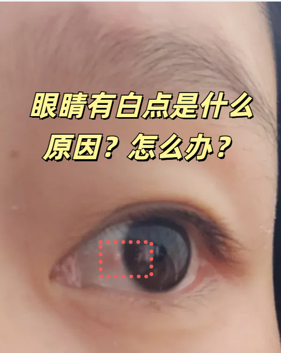 白眼球发蓝怎么回事