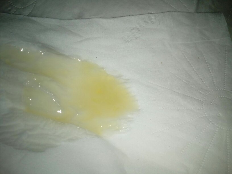 精液射出后图片这样正常吗