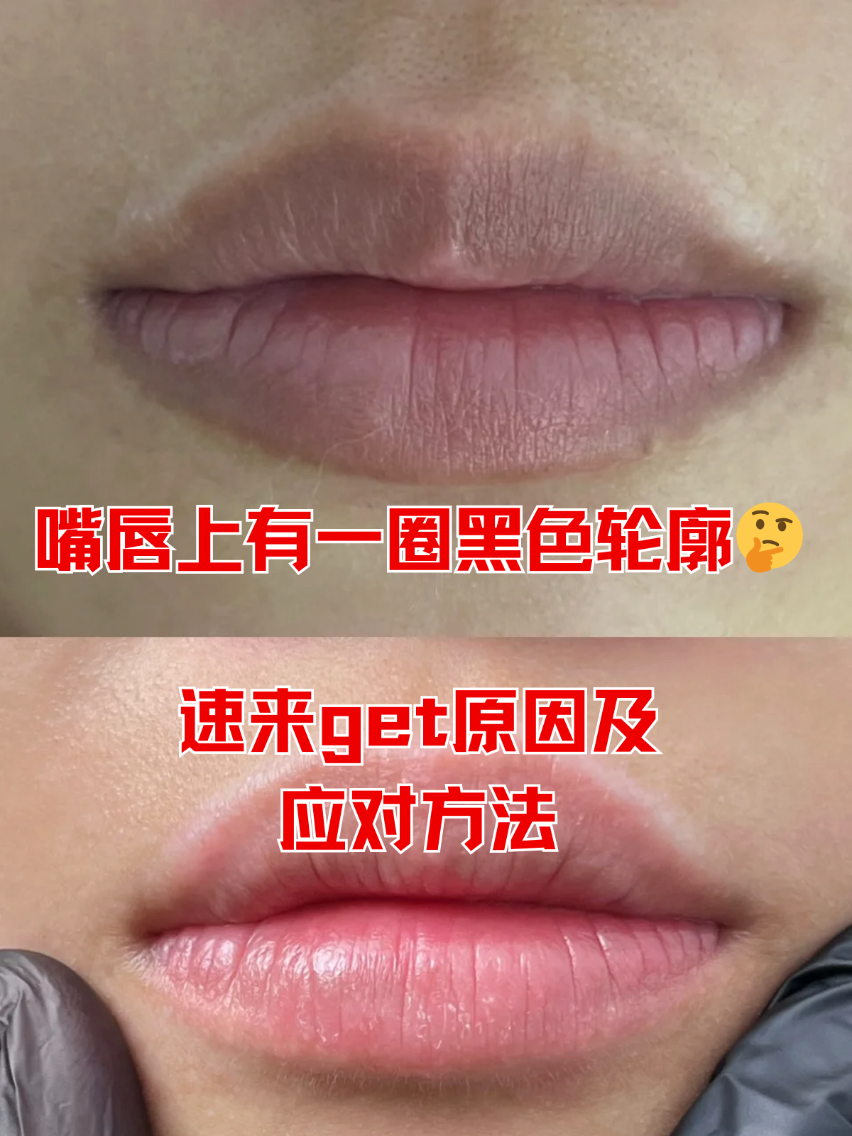 嘴唇发紫怎么回事