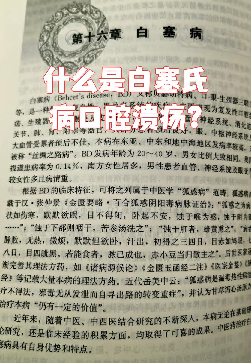 什么人容易得白塞氏病