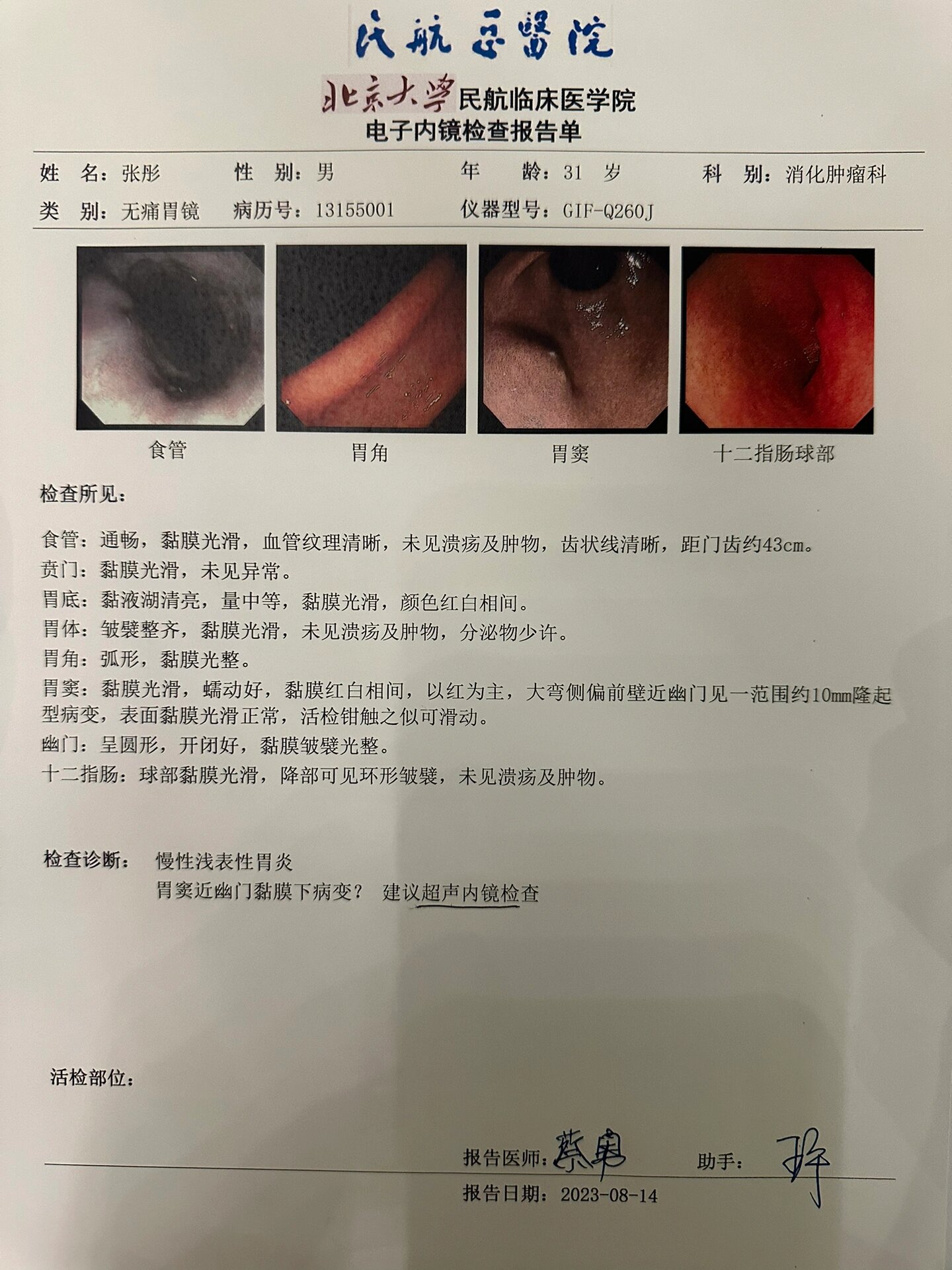 胃镜结束出现胃痛正常吗