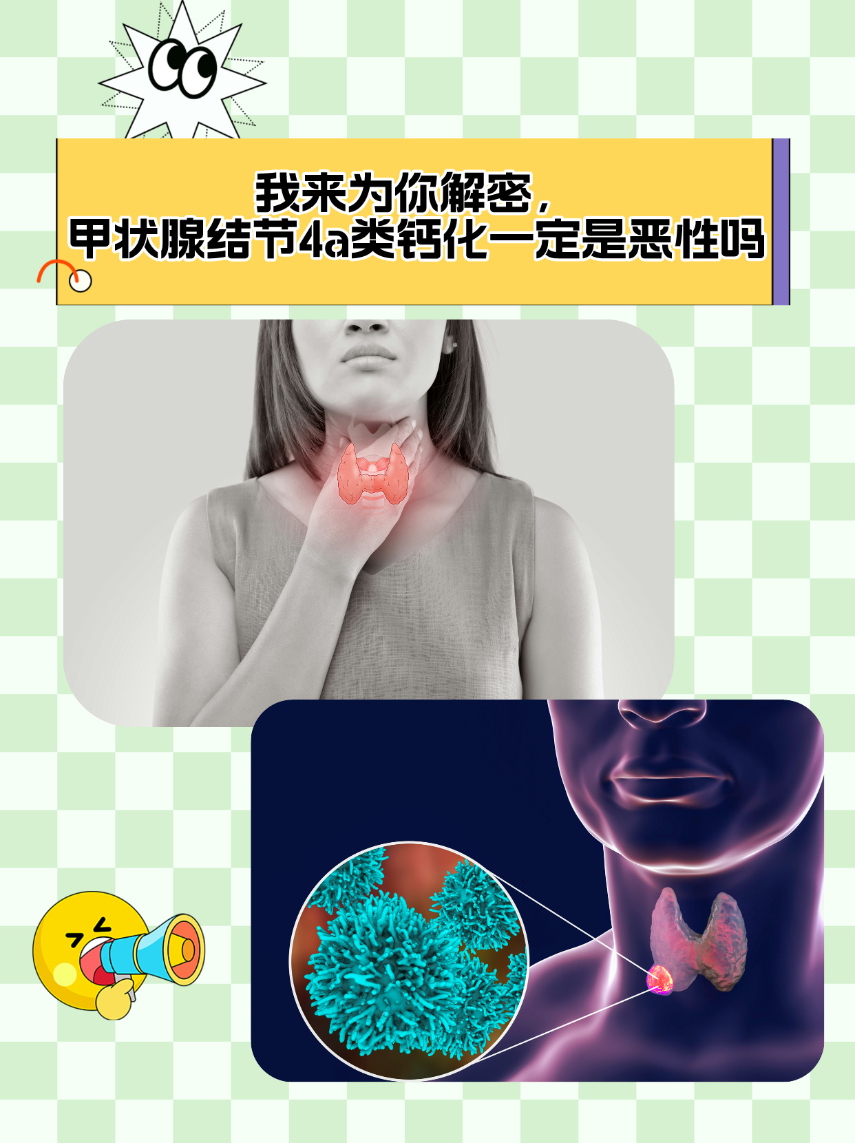 甲状腺结节患者能活多久?