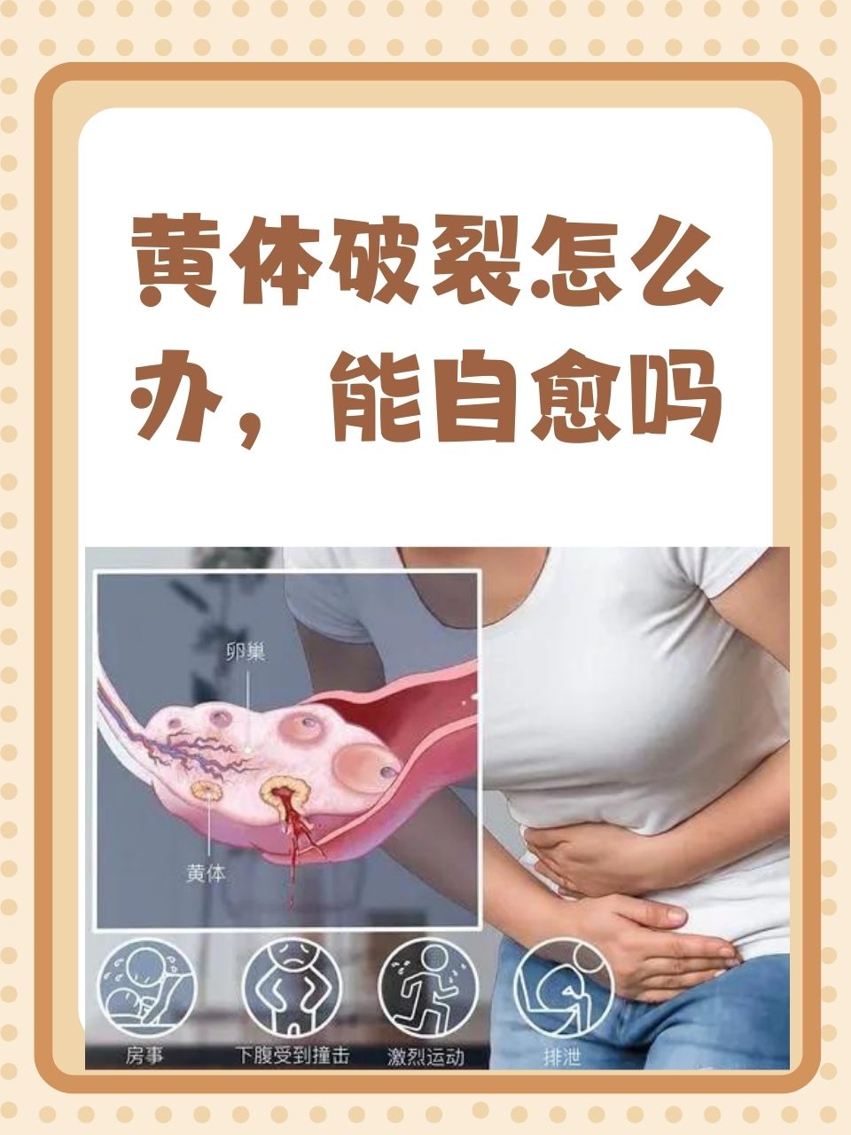 黄体功能不全怎么治