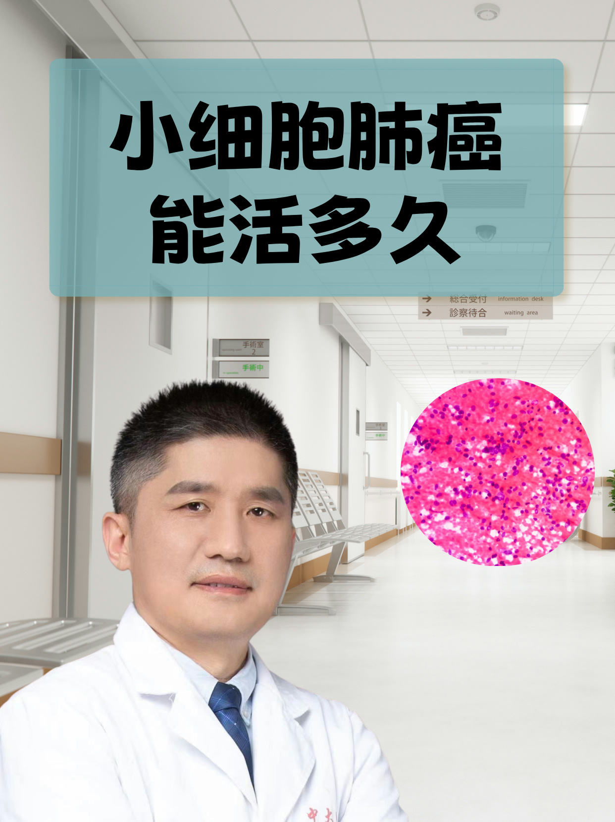 非小细胞肺癌是什么?