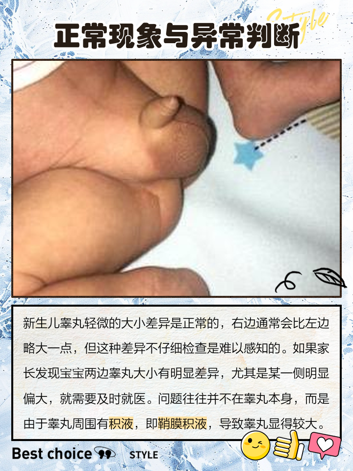 两个睾丸不一样大