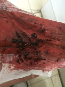 月经排出来血块好吗