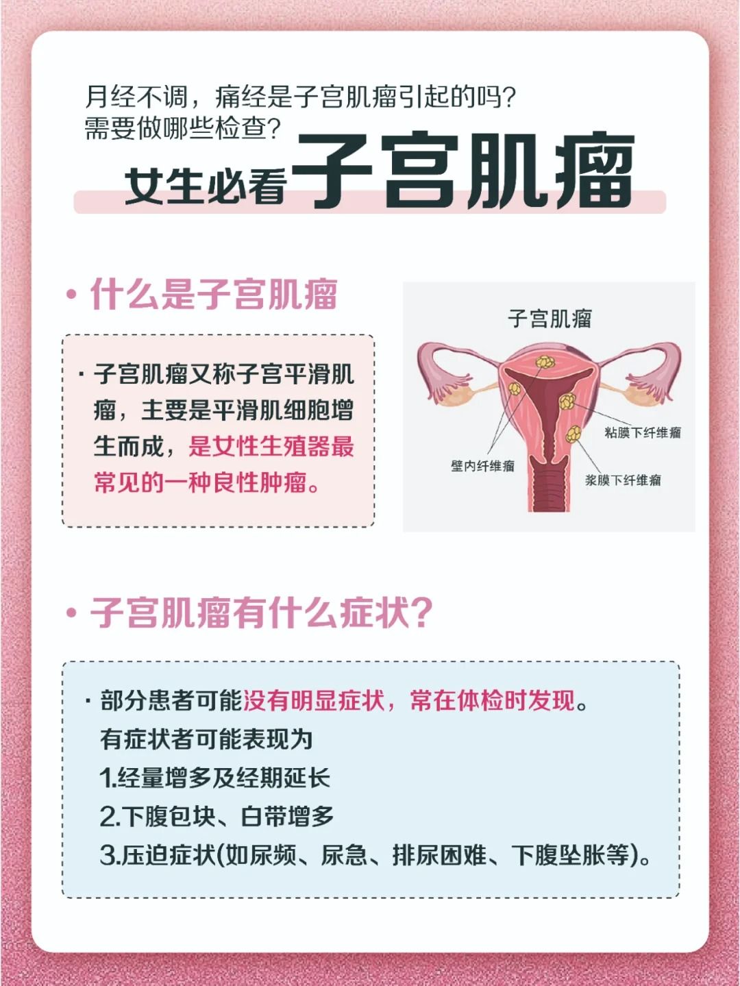 子宫肌瘤可以怀孕吗