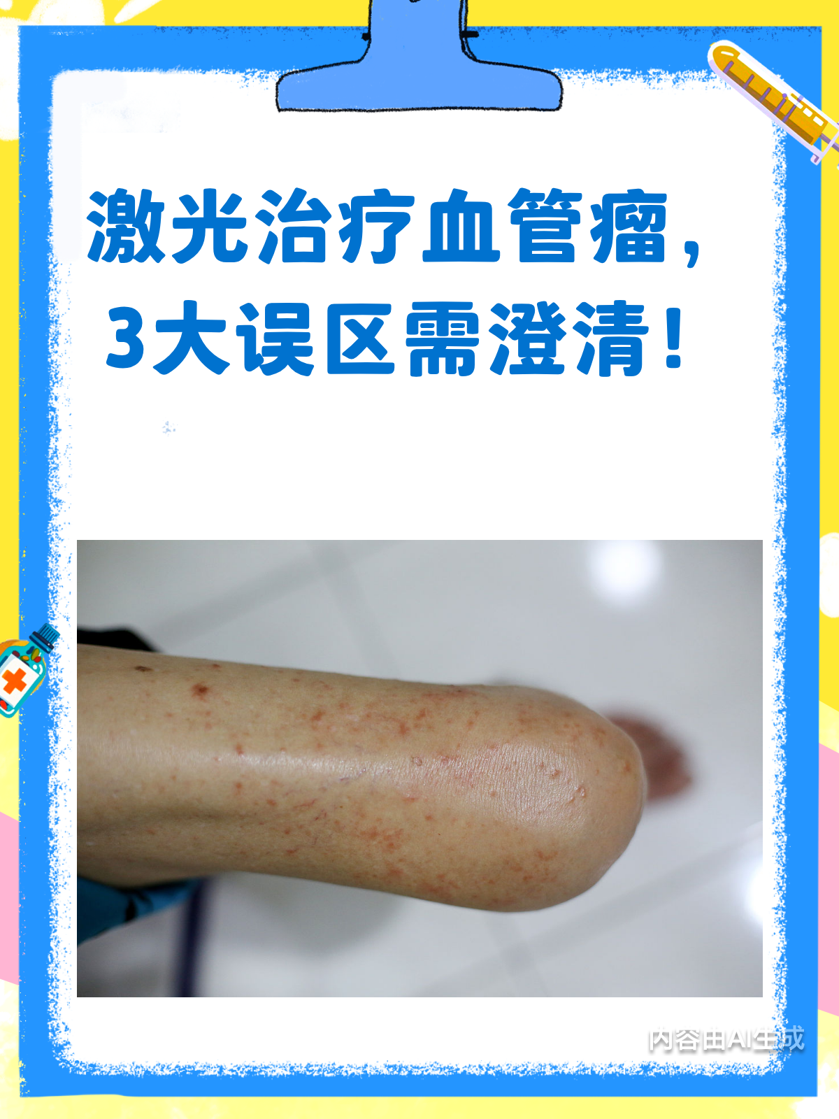 血管瘤可以手术治疗吗?