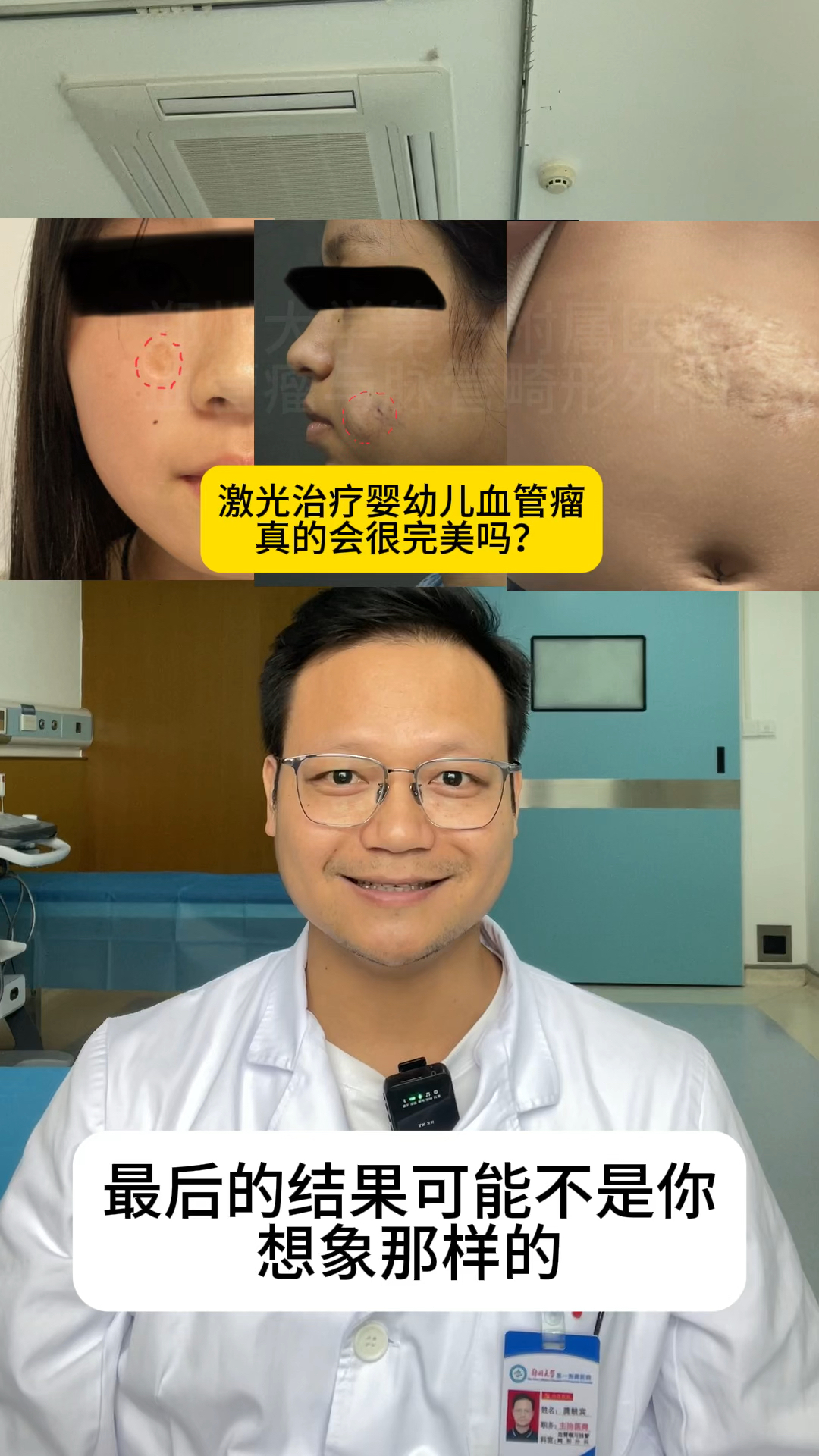 血管瘤可以手术治疗吗?