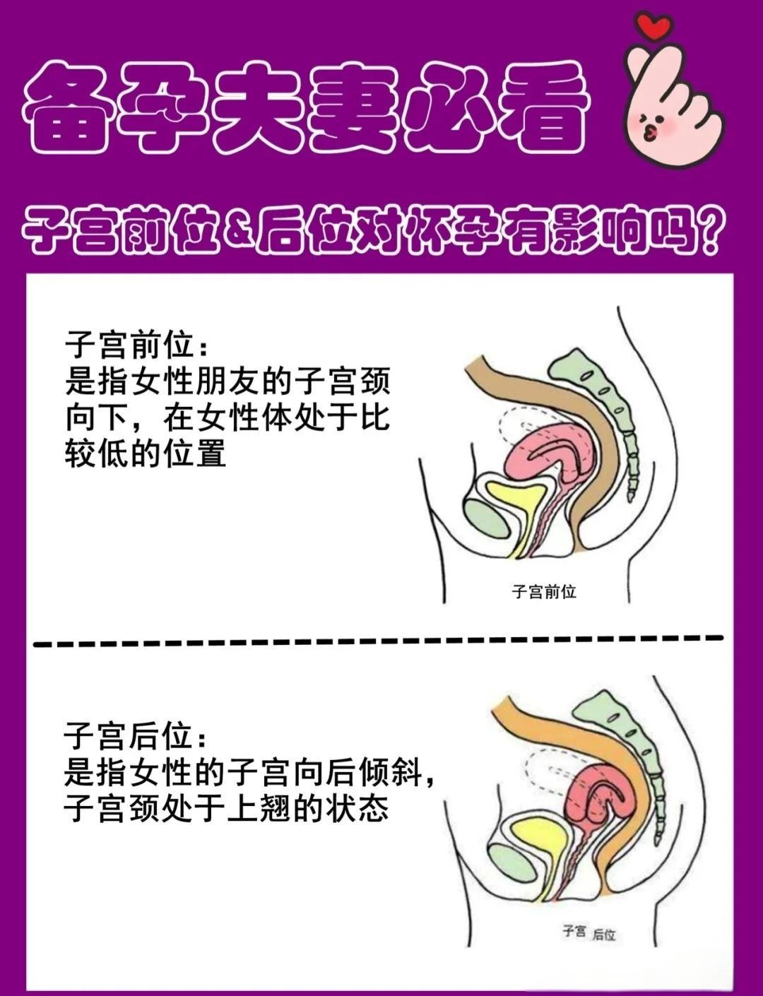 子宫偏小可以怀孕吗