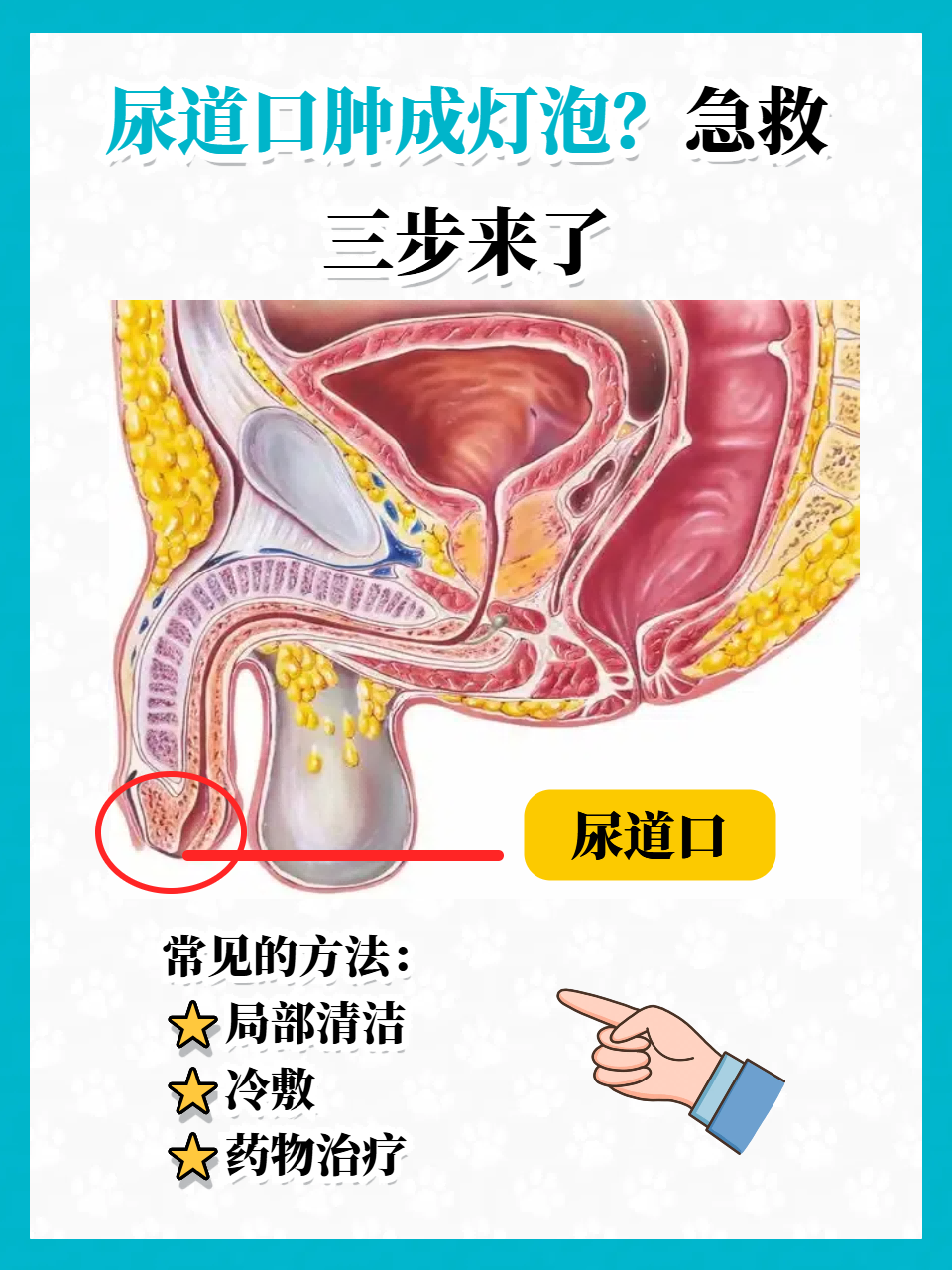 男性小便时尿道刺痛是什么原因