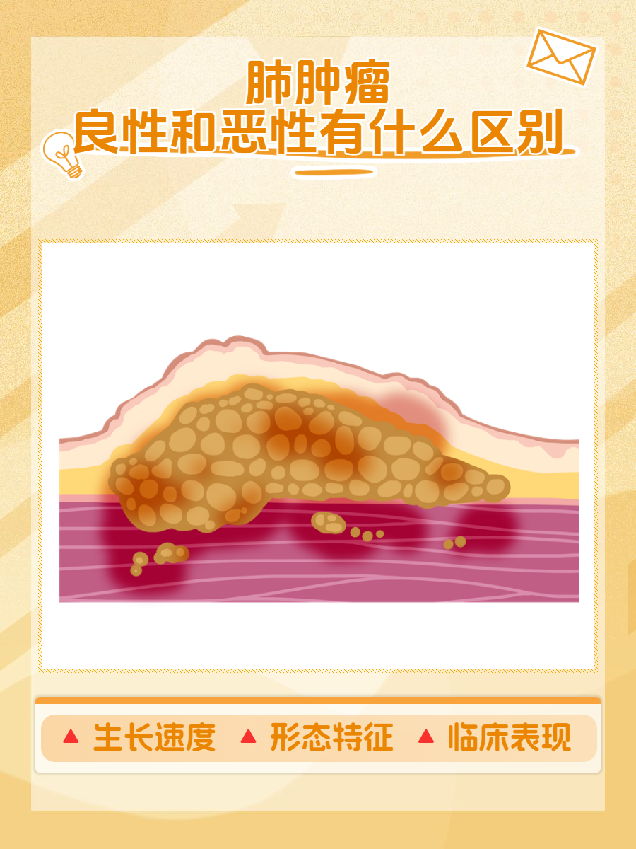 肺部肿瘤和肺癌的区别