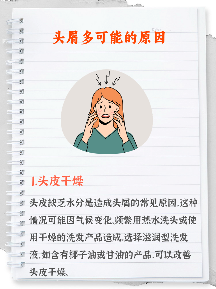头皮干燥起头屑怎么办