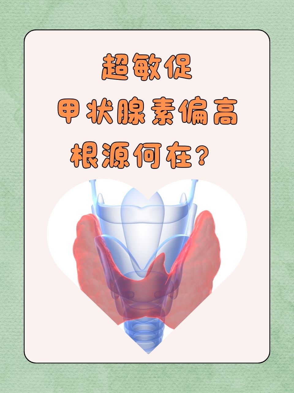 游离甲状腺素高是怎么回事