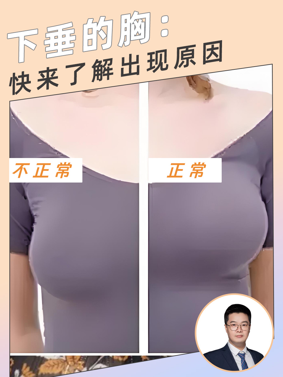 乳房下垂的原因有哪些