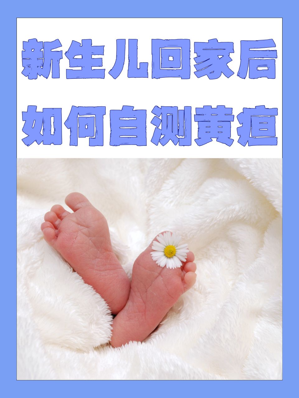 什么是新生儿黄疸指数?