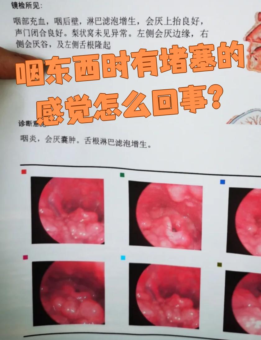 喉咙总感觉有东西堵着怎么回事