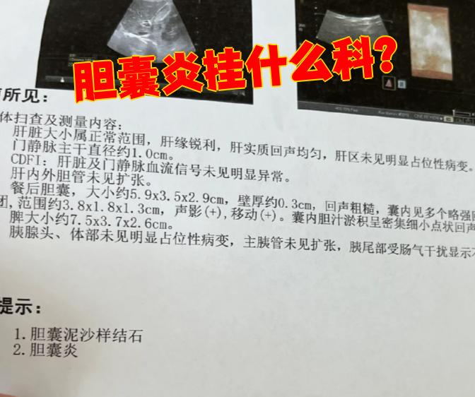 胆结石挂什么科