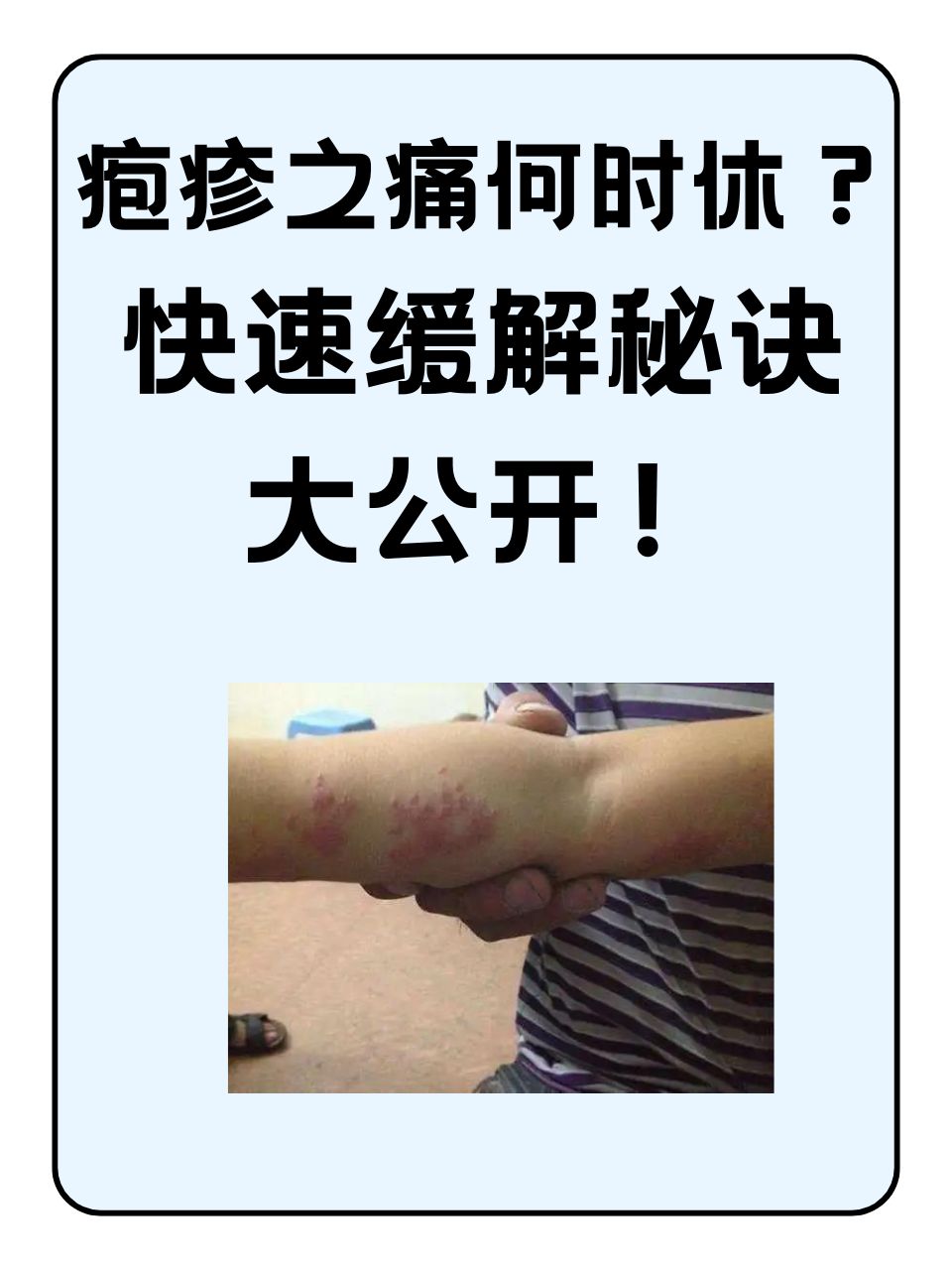 带状疱疹是怎么引起的