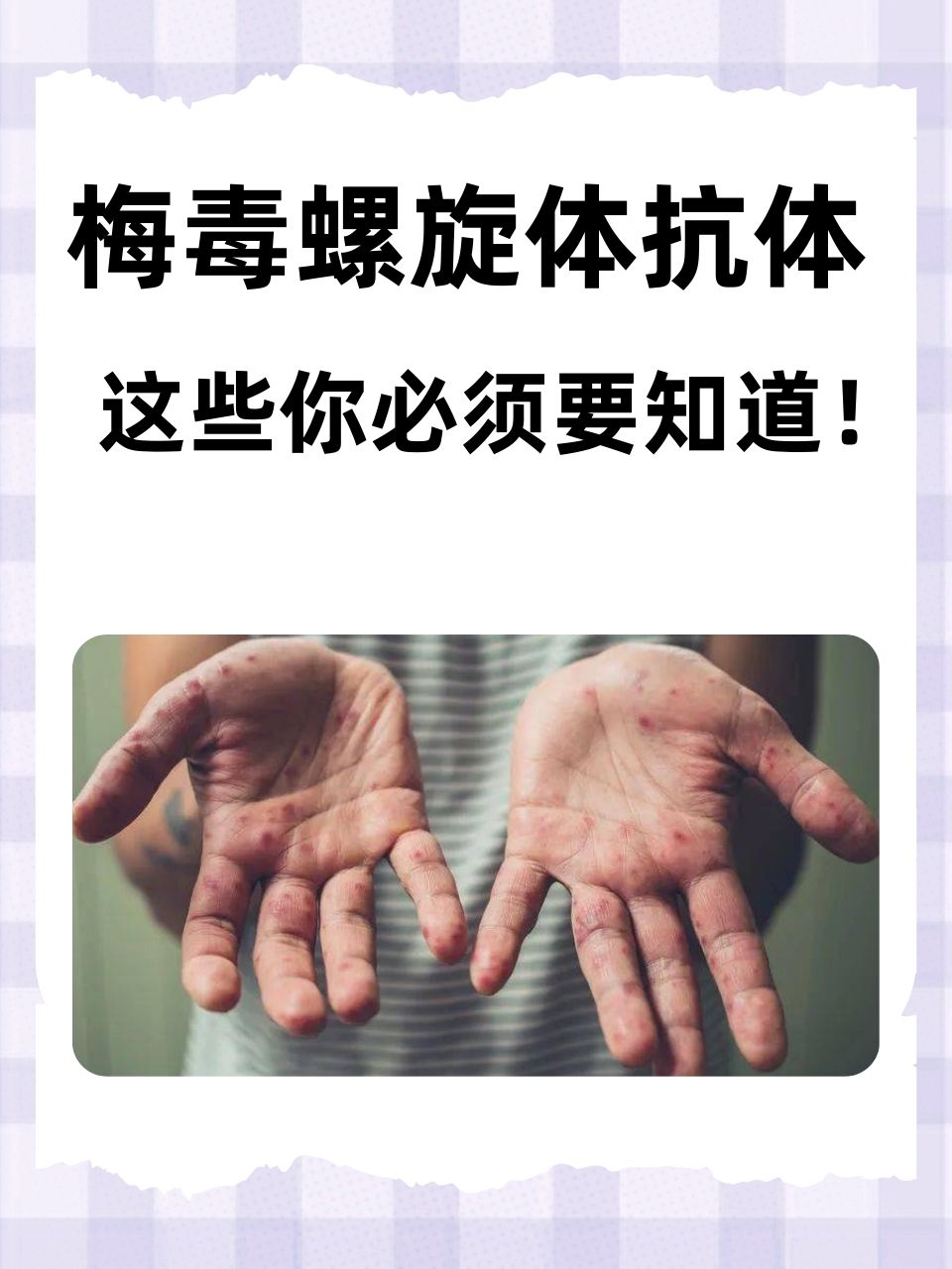 梅毒检测方法有几种