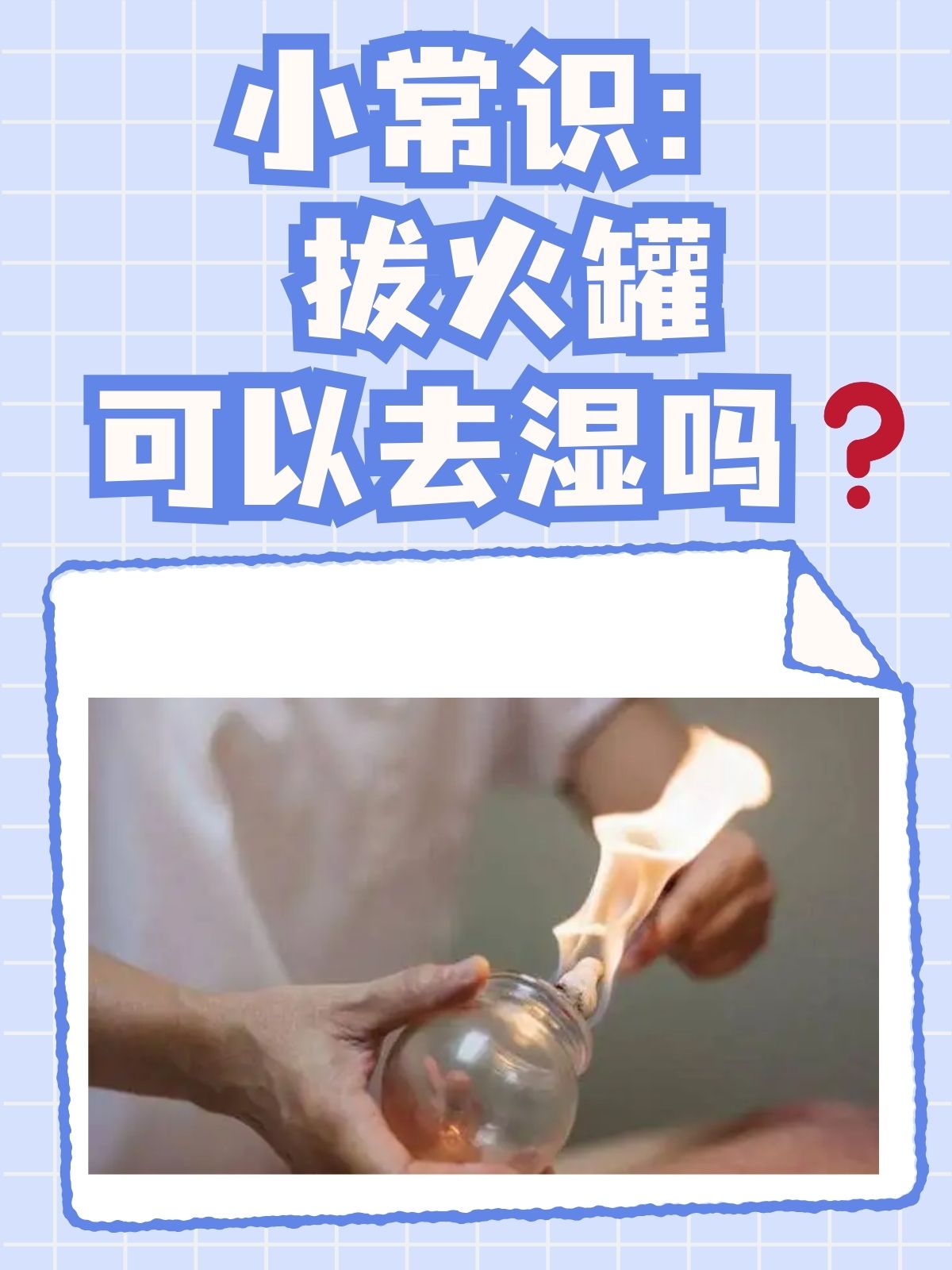 怀孕可以拔火罐吗