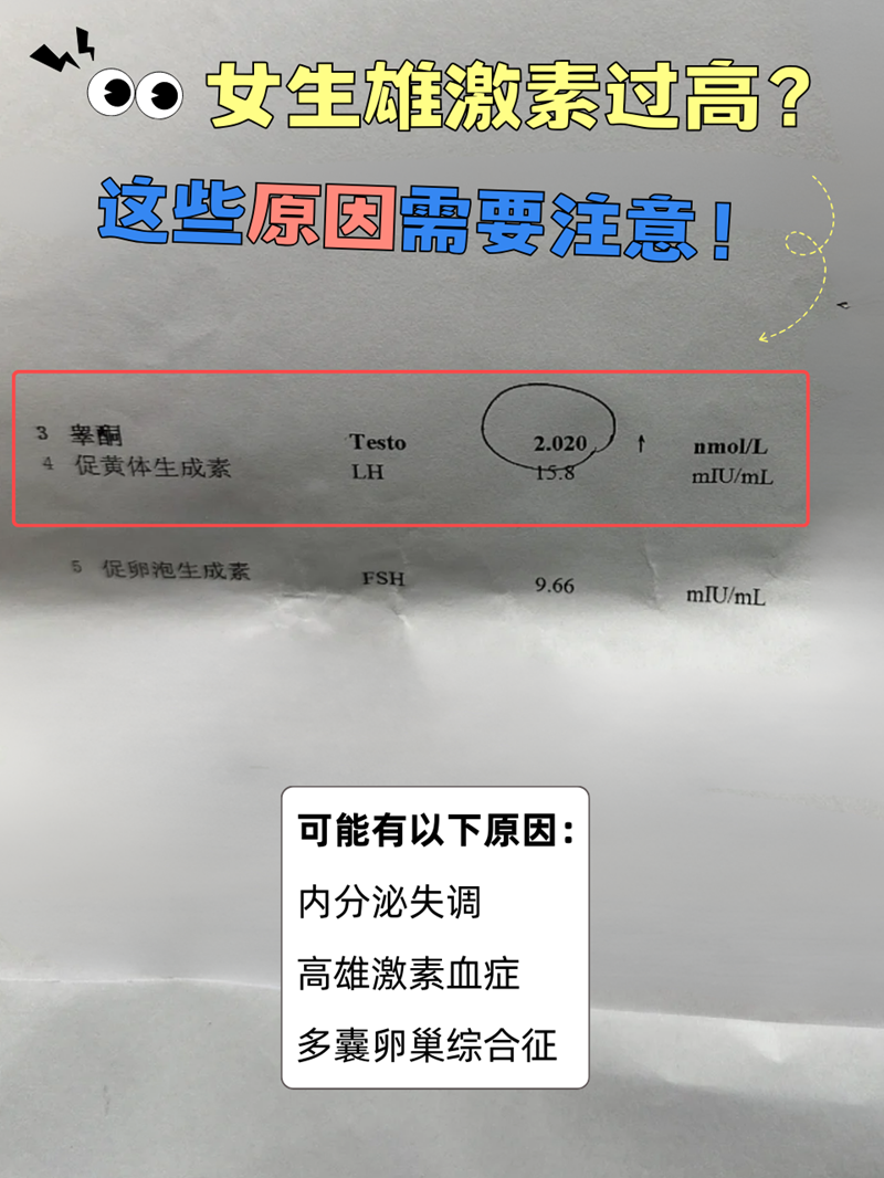 女性睾酮高可治愈吗