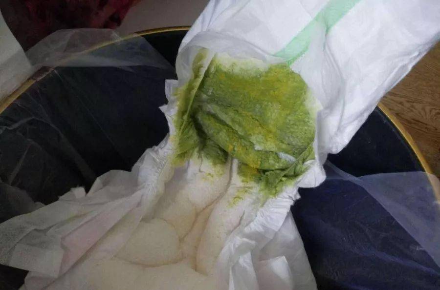 新生儿20天连续两天拉绿色便便怎么回事